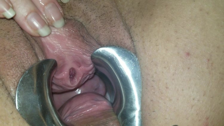 Rare Sex Photo Download Urethra Stretching