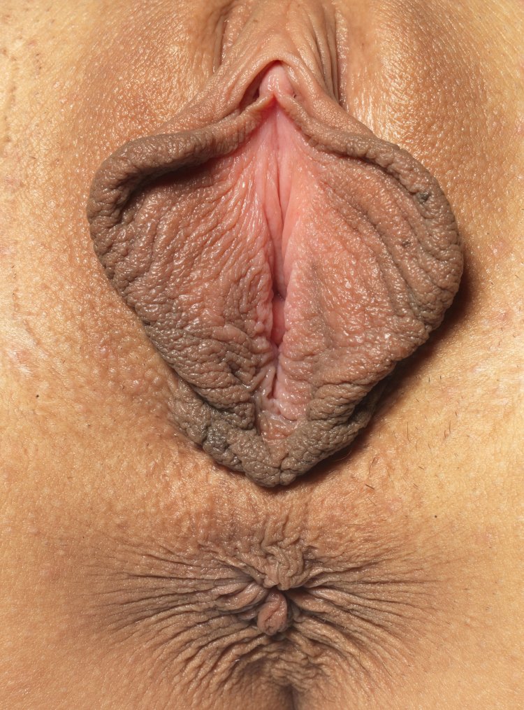 Beautiful genitals