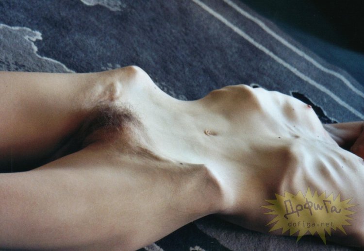 Anorexic girls nude