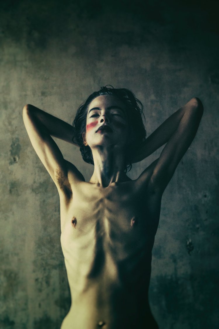 Naked anorexics Asian