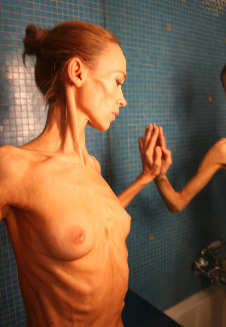 Naked anorexici with big breasts