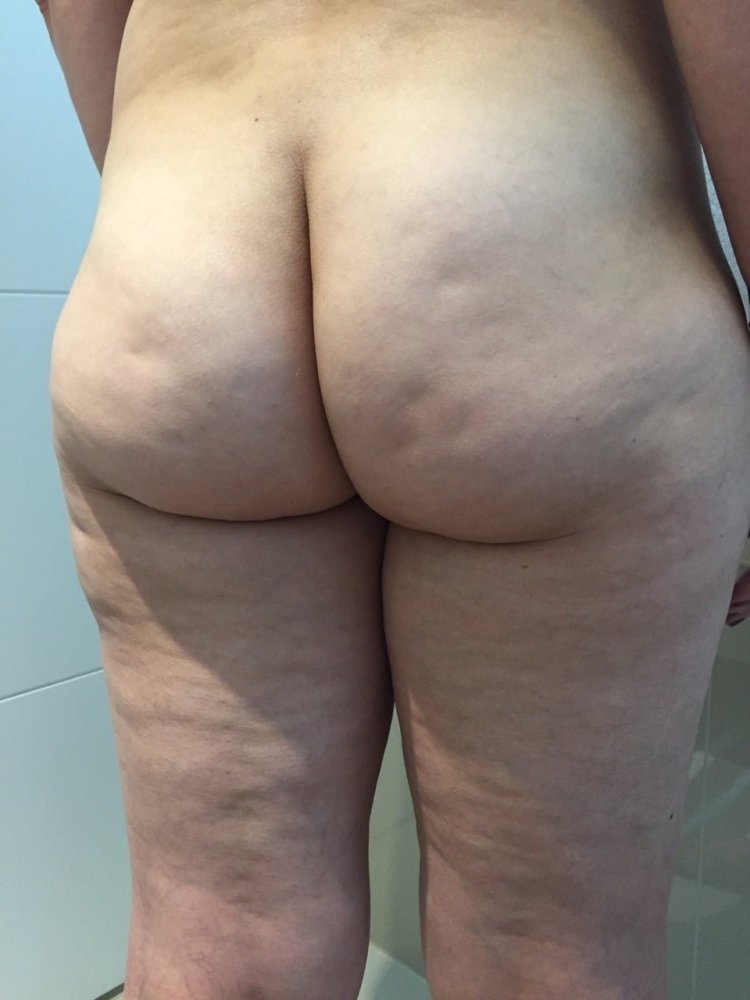 Naked butts with cellulite
